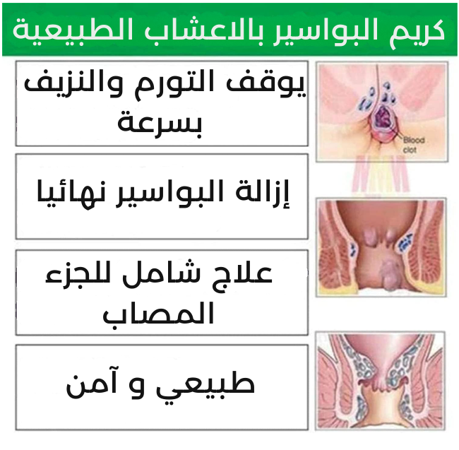 DICTAMNI مرهم البواسير